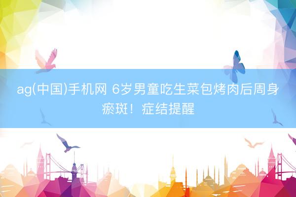 ag(中国)手机网 6岁男童吃生菜包烤肉后周身瘀斑！症结提醒